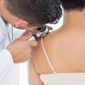 Skin Cancer Prevention and Detection